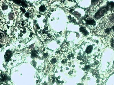 Tinción de Gomori methenamine plata muestra Histoplasma Capsulatum