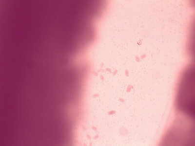 Tricocéfalo  parásito
