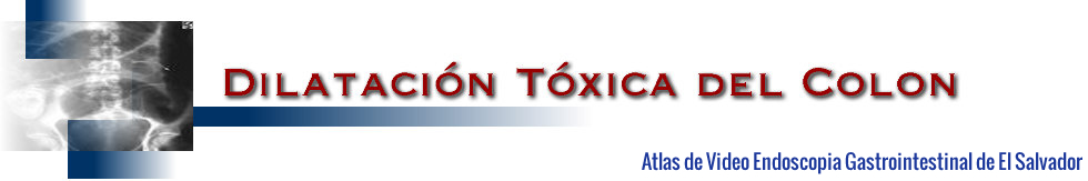 Megacolon Toxico