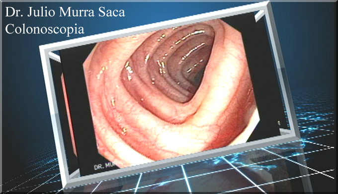 Gastroenterologo El Salvador