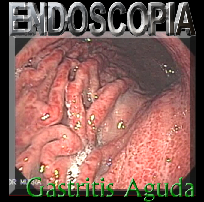 Gastroenterologo Santa Tecla