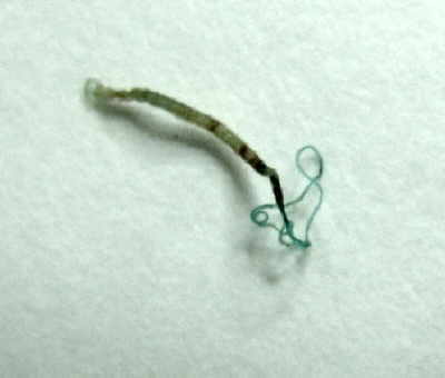Trichuris Trichuris (whipworm).